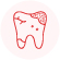 Advanced Periodontitis