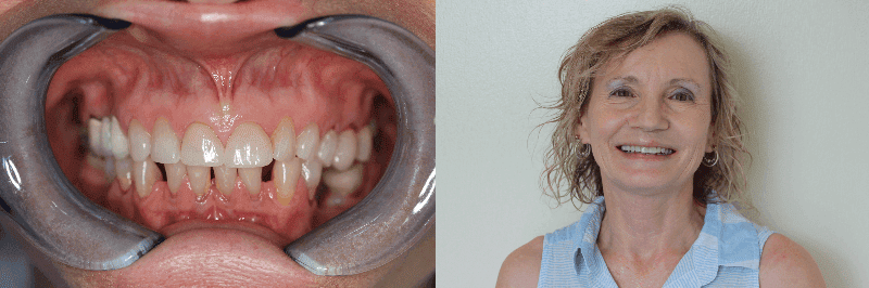 Case Two - Before