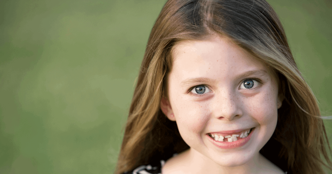 Crooked Teeth and Misaligned Bites Causes and Treatments