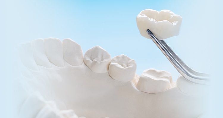 Dental crown vs filling treatment comparison