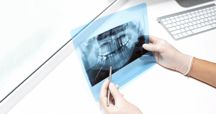 Dental x rays