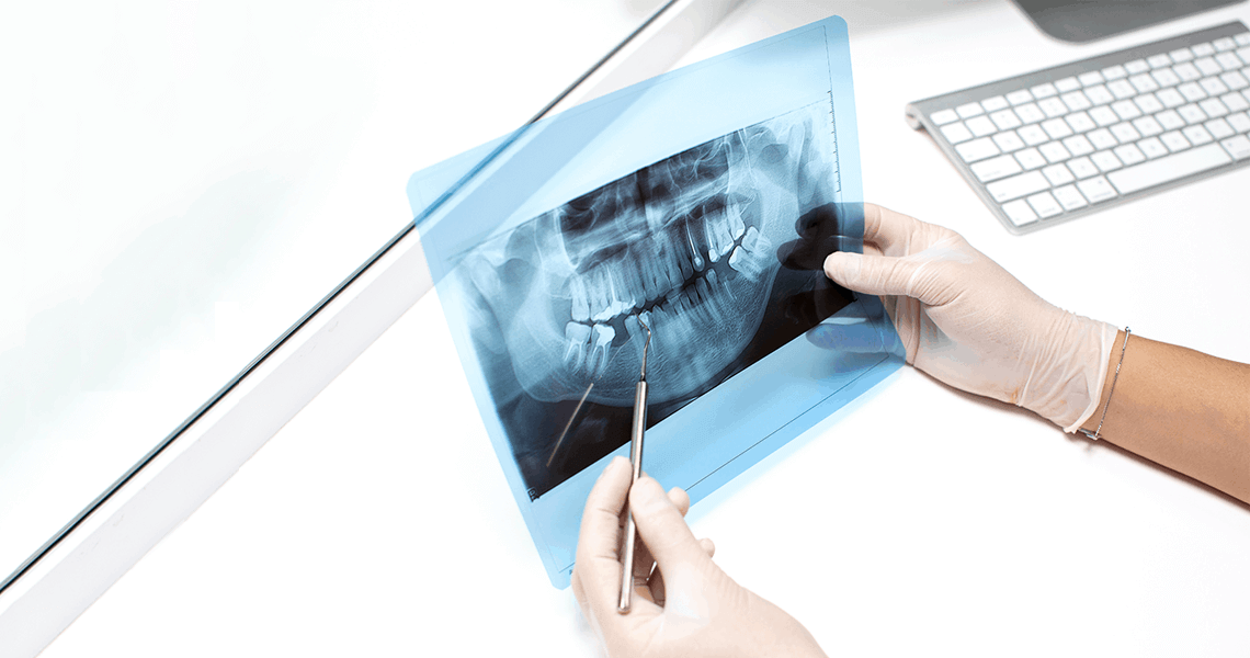Dental x rays