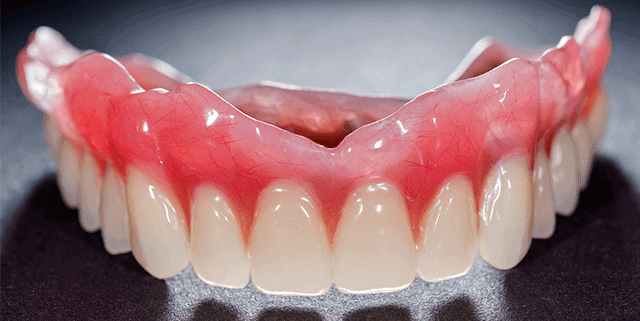 Dentures
