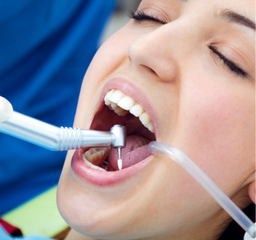 How Dentists Assess A Loose Filling Or Crown