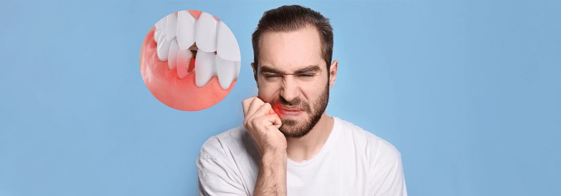 How-Periodontal-Exams-Help-In-Gum-Disease-Prevention