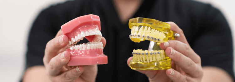 Invisalign vs. Traditional Braces