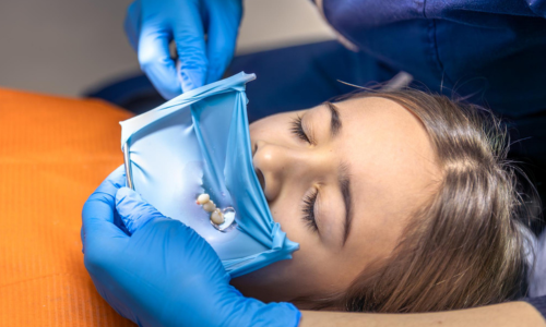 Lost Fillings Or Crowns