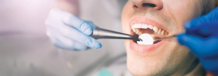 cosmetic dentistry myths