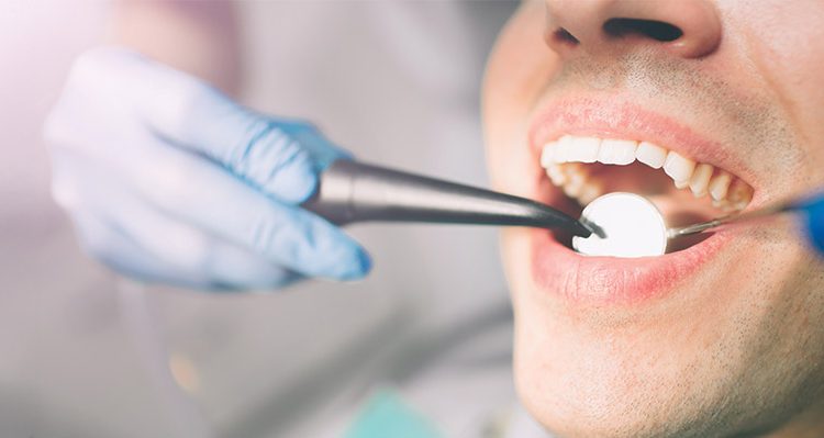 cosmetic dentistry myths