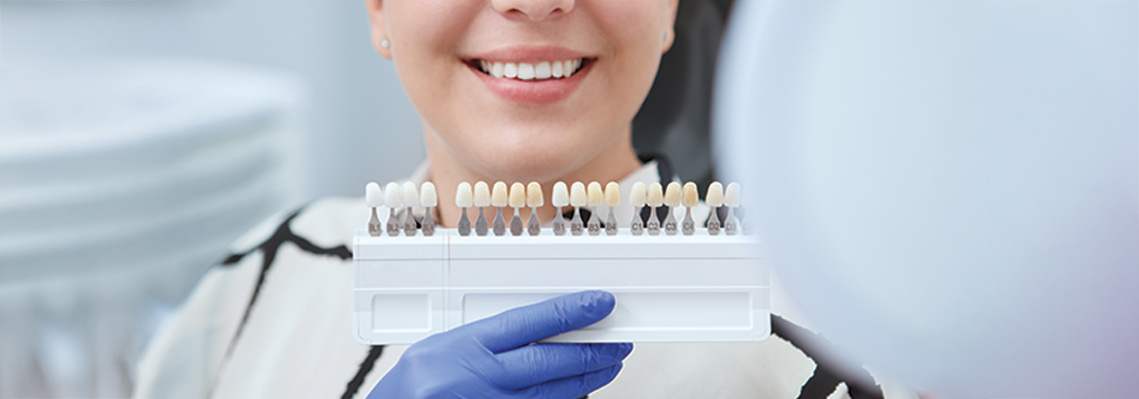 Tooth Coloured Fillings