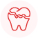 Tooth Decay 1