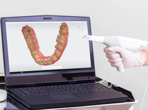 Trios 5 Intraoral scanner 1
