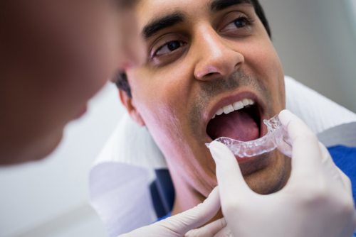 Understanding Invisalign Clear Aligners Made Simple