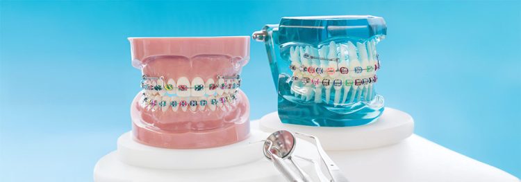 Orthodontic retainer for teeth alignment after braces
