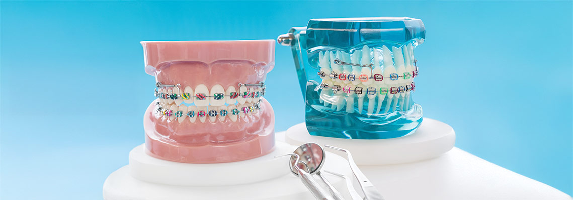 Orthodontic retainer for teeth alignment after braces